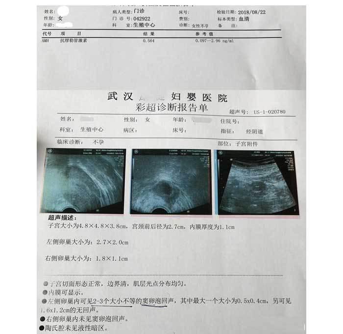 amh检查报告