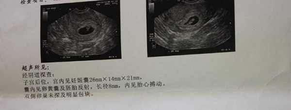 想生男孩可以做试管代怀是不是违法吗（想生男孩可以做第3代试管代怀哪家医院好点吗）