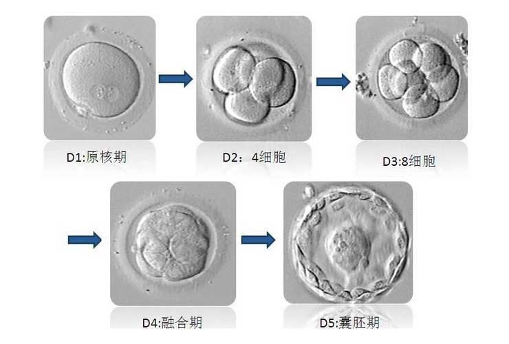 养囊的流程