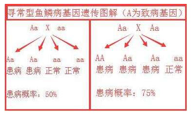 鱼鳞腿遗传方式